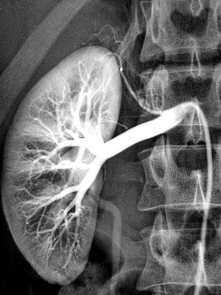 Organspende rettet Leben